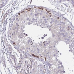 TMEM8C Antibody, Novus Biologicals 0.1mL; Unlabeled:Antibodies, Polyclonal
